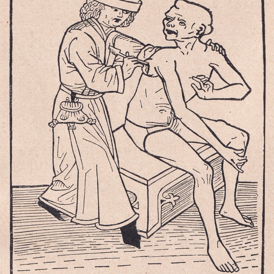 Chirurg nacinający dymienicę, drzeworyt z dzieła Spruch von der Pestilenz Hansa Folza, Niemcy, Norymberga, 1482, przerys grafiki z publikacji: Ł. Charewiczowa, Klęski zaraz w dawnym Lwowie, Lwów 1930, w zbiorach Muzeum Mikołaja Kopernika we Fromborku